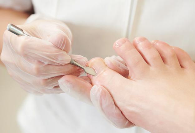 Medizinische Fußpflege