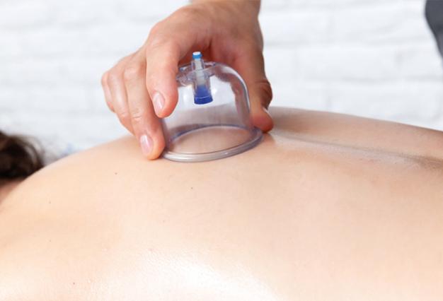 Rücken-Schröpfmassage